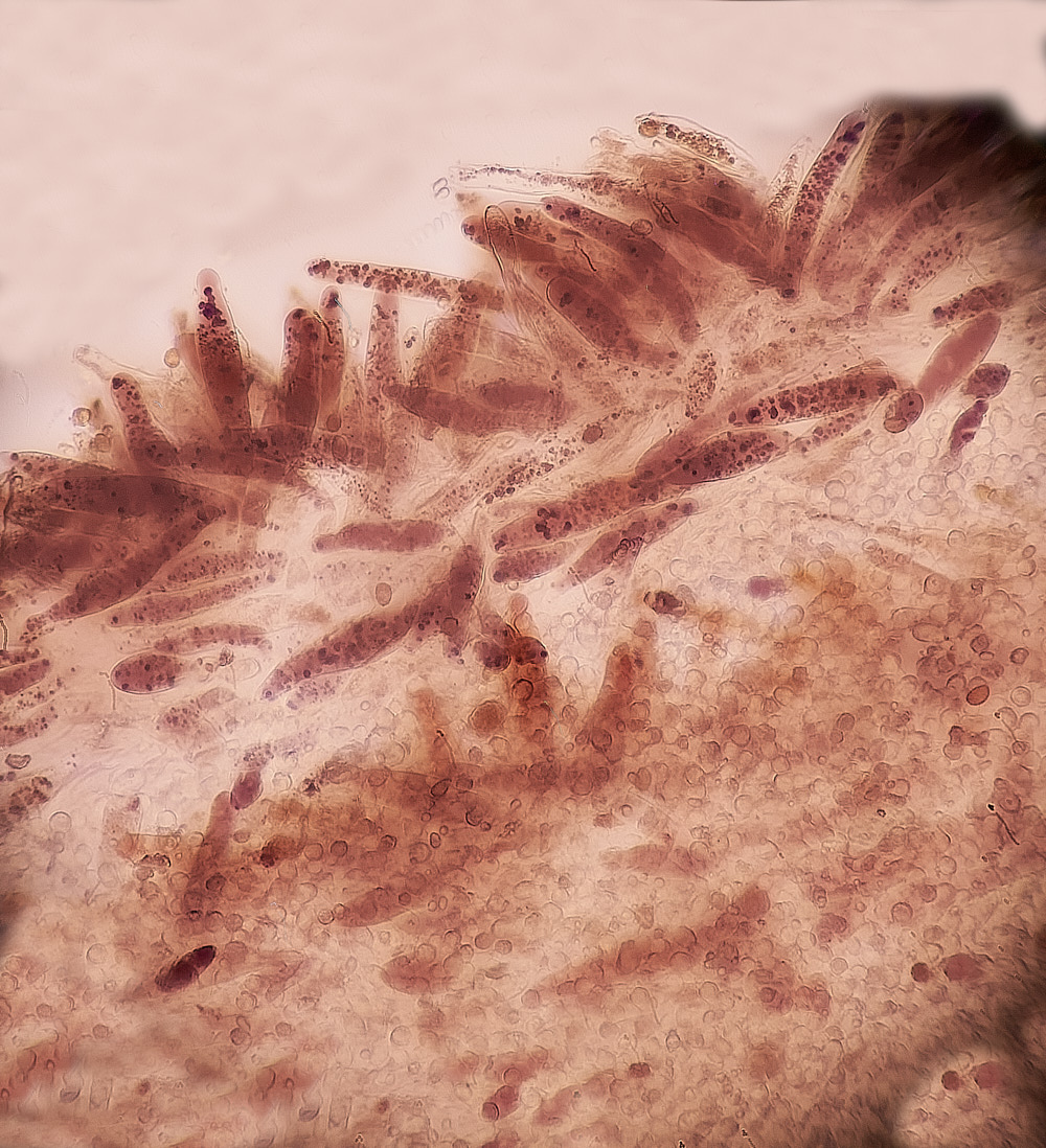 HolkhamBlackedgeBonnet171123-4