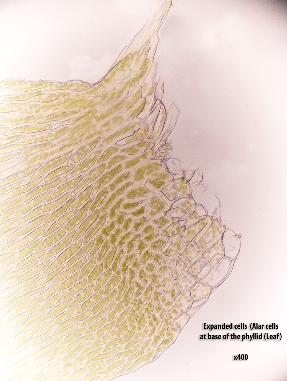 KenHillSstrumulosum-2 1